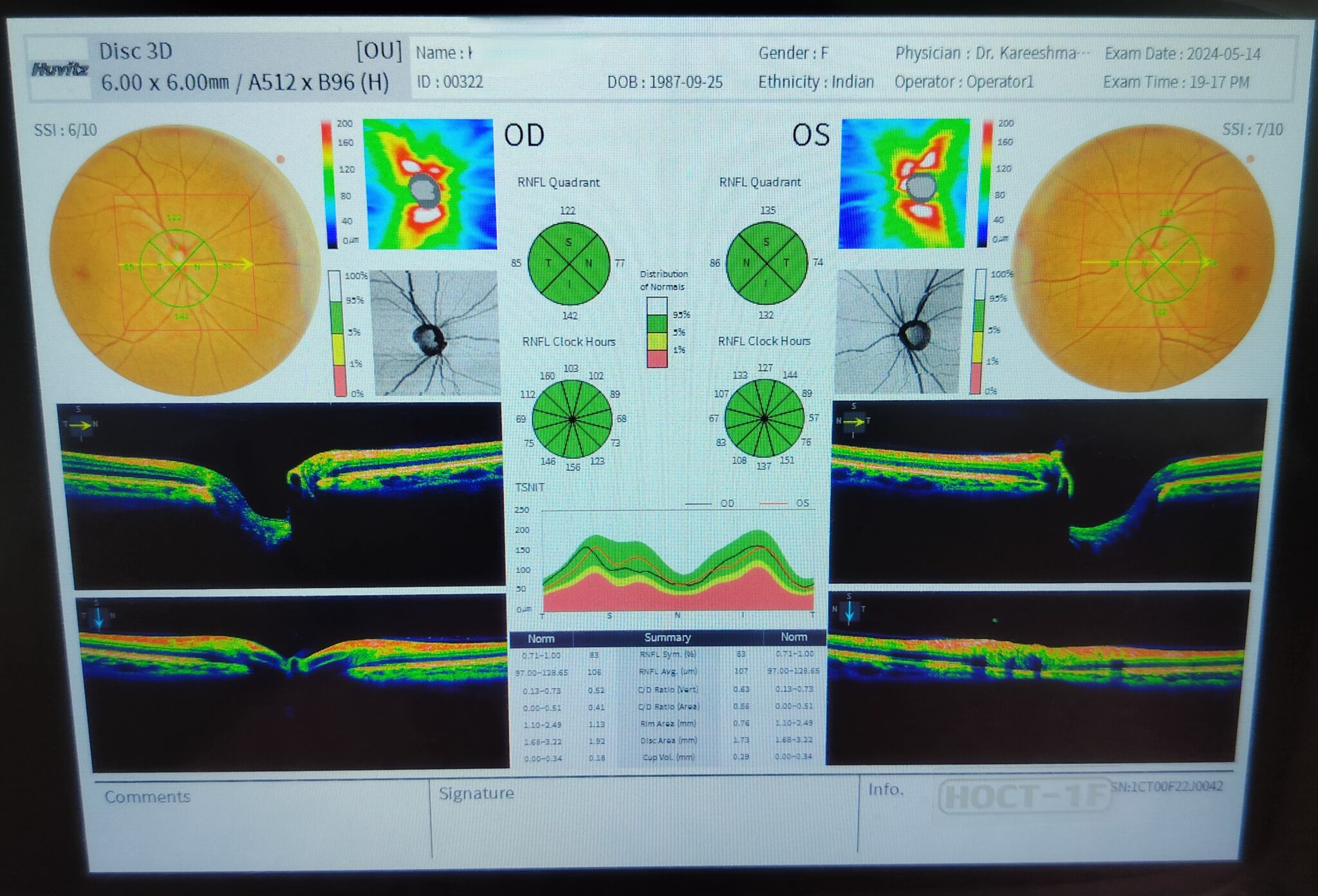 Cornea Image