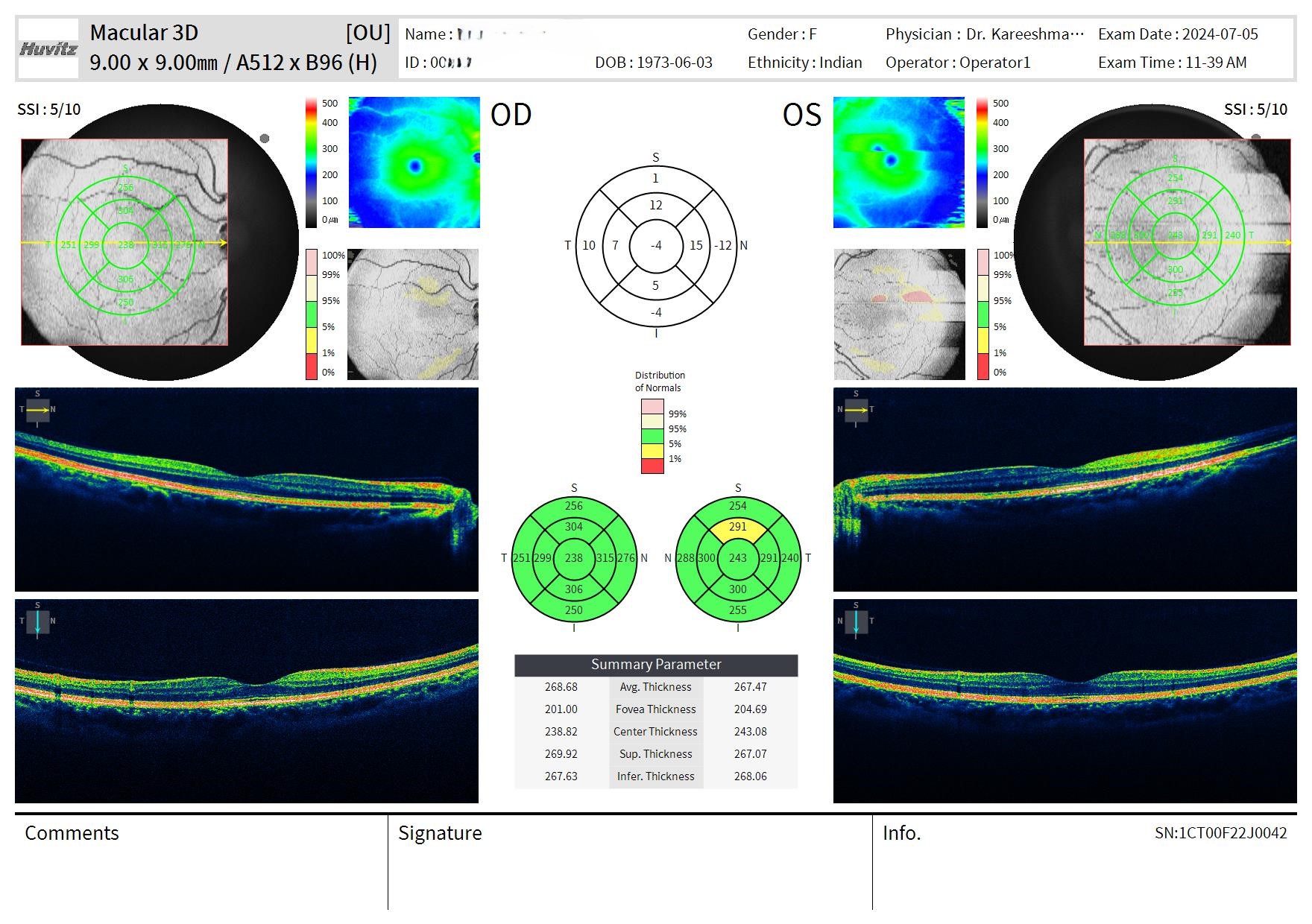 OCT MACULA SCAN
